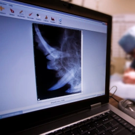 Digital Radiography